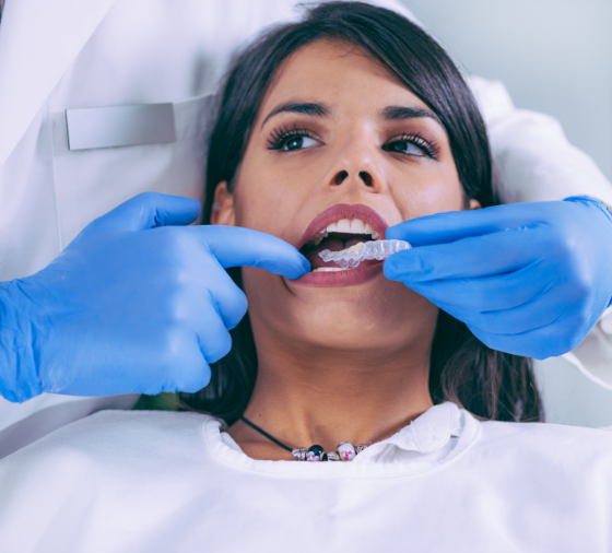 Blanqueamiento dental Valencia - Clinica dental Valencia - Dentista Valencia - Clinica Peydro