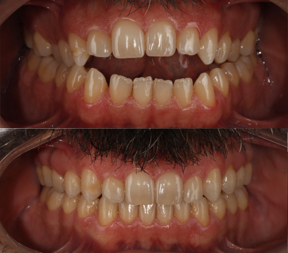 estética dental en Valencia - Clínica Peydro
